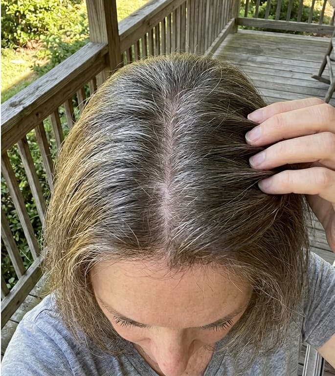 Patricia R. after using Rosemary & Lavender Hair Growth Oil