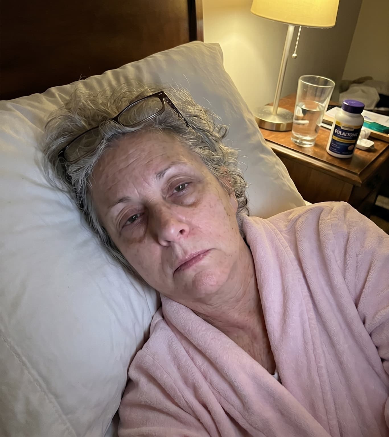 Dorothy M. before using Lavender & Chamomile Sleep Balm