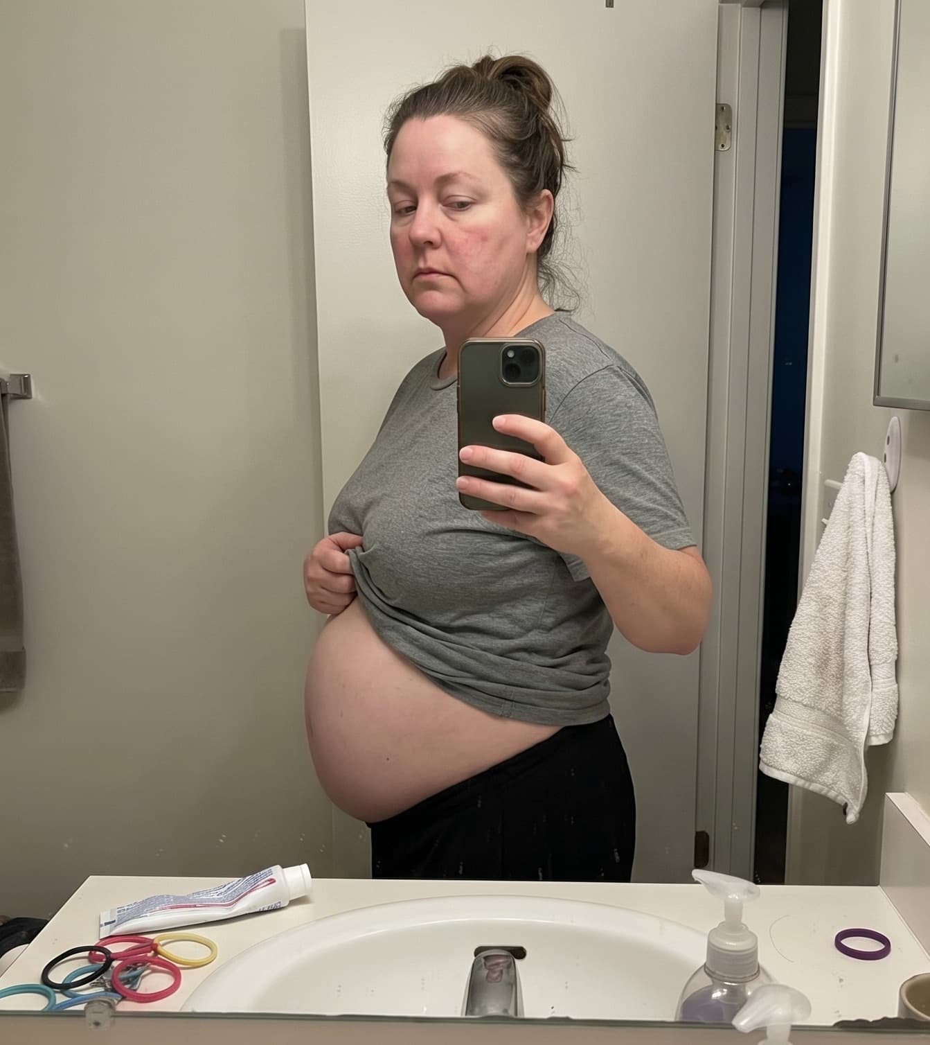 Linda T. before using Mugwort & Angelica Digestive Tea